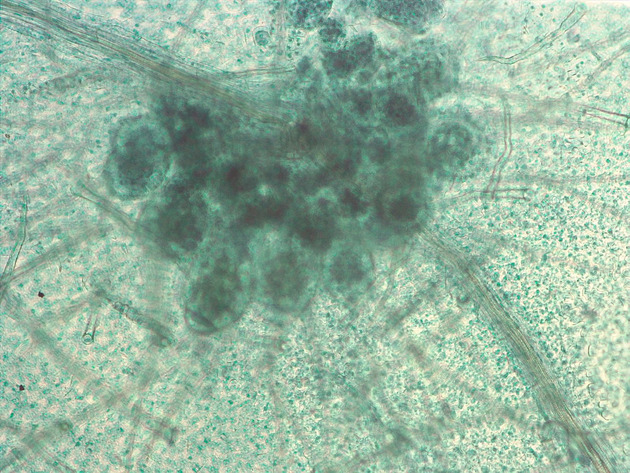 Fern Sori Slides - Fern Sori 03 100X